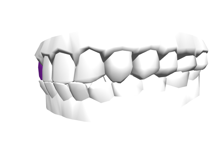 Right side view
