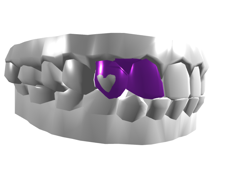 Left side view