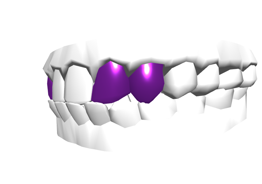 Right side view